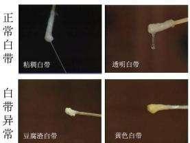 最新白带图片解析，全面了解白带与图片获取方法